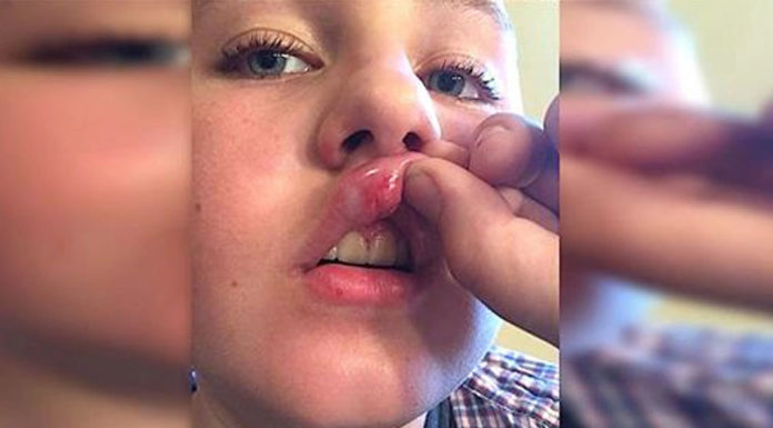 Firemen Drive Bullied Boy Home – Hours later, Mom sees Strangers on Her Front Lawn