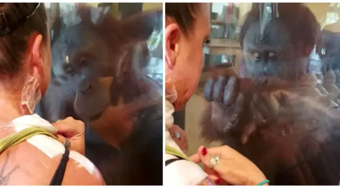 Burn Victim Visits Orangutan, His Reaction Takes Everyone By Surprise