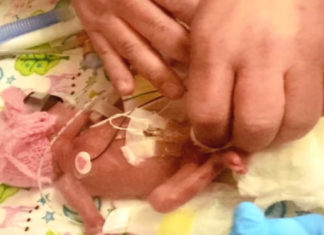 Born Just After 24 Week Abortion Limit, 9 Months On, Doctors Can’t Believe What They See!