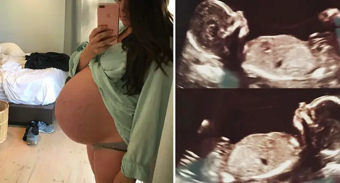 Woman Gives Birth, Then Six Weeks After Another Miracle Happens…