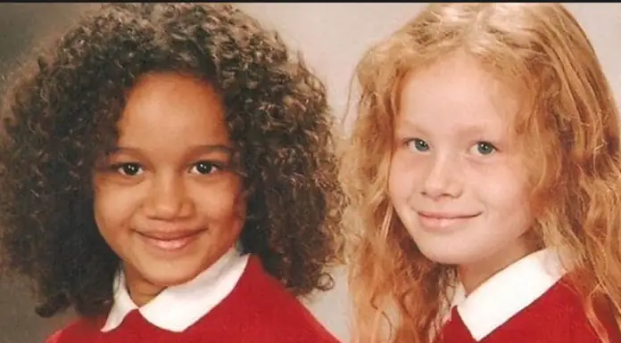 20 Years After Their Birth Captivated The World, The Aylmer Twins Are All Grown Up