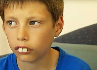 Boy called “rabbit” and bullied for his teeth gets incredible transformation