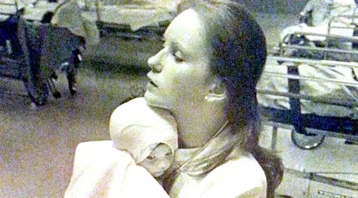 In 1977, nurse saved badly burned baby. 38 years later, she sees her old photo on Facebook and freezes