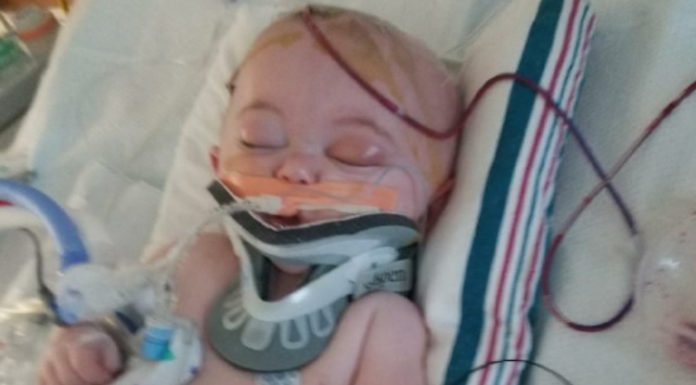 Baby Suffers Brain Damage After Fall From Bed