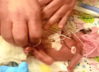 Born At Two Pounds, Mom’s Baby Girl Defies All Odds