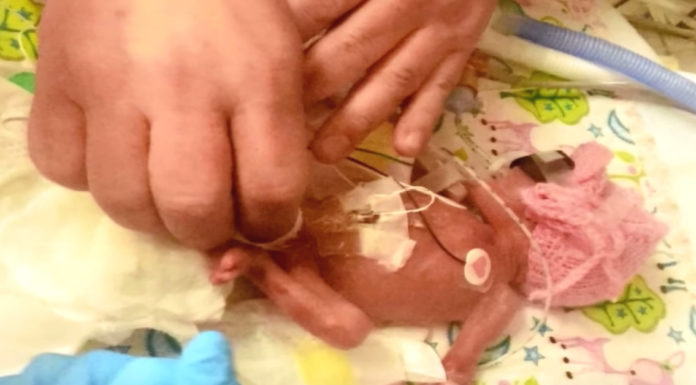 Born At Two Pounds, Mom’s Baby Girl Defies All Odds