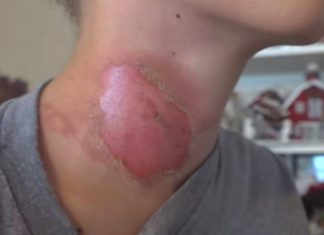 Latest ‘Challenge’ Causes Kids To End Up In The Hospital