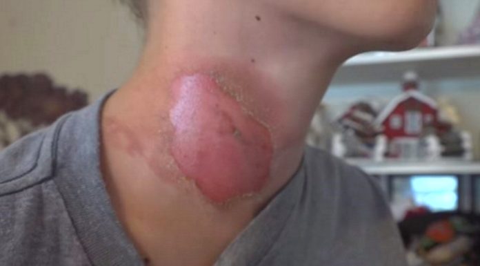 Latest ‘Challenge’ Causes Kids To End Up In The Hospital