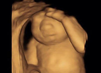 Husband’s Emotional Post About Wife’s Terminal Pregnancy