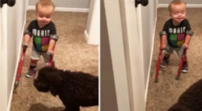 Proud Little Boy Shows Off His New Crutches To Family Dog – It’s The Sweetest Thing You’ll See Today