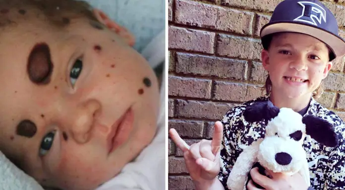 Dylan Little’s amazing journey: The boy who has proven his doctors wrong so many times