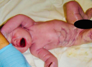 Mom delivers rainbow baby, only for dad to utter: ‘There’s something wrong’