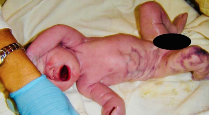 Mom delivers rainbow baby, only for dad to utter: ‘There’s something wrong’