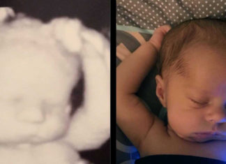 Mom Notices Stunning Similarity Between Baby’s Ultrasound And Now