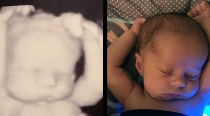 Mom Notices Stunning Similarity Between Baby’s Ultrasound And Now
