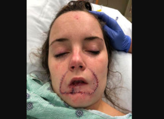 Teen Stops Blaming Herself After Boyfriend Leaves His Mark