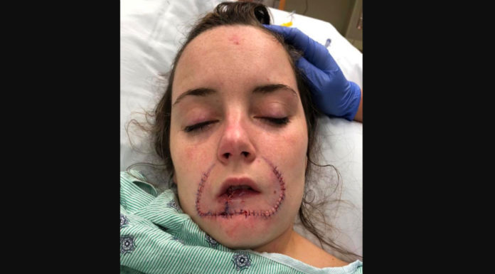 Teen Stops Blaming Herself After Boyfriend Leaves His Mark