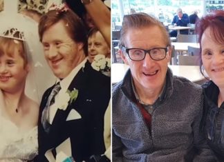 Against All Odds, Couple With Down Syndrome Celebrates Their 24-Years Wedding Anniversary