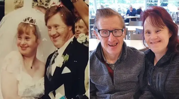 Against All Odds, Couple With Down Syndrome Celebrates Their 24-Years Wedding Anniversary