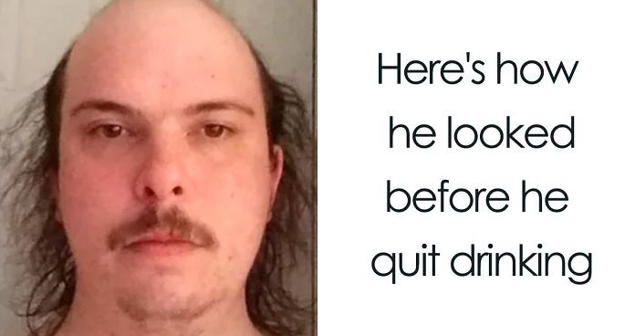20+ Before & After Pics That Show What Happens When You Stop bDrinking