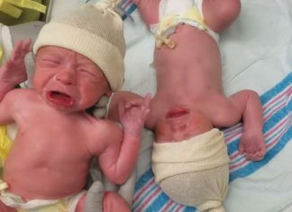 Twin Brothers Comfort Each Other Just Moment After Birth