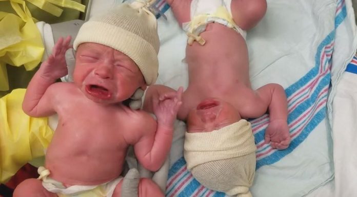 Twin Brothers Comfort Each Other Just Moment After Birth
