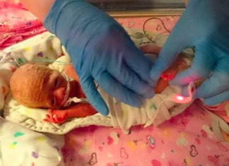 Premature baby spent her first weeks in a sandwich bag and it saved her life