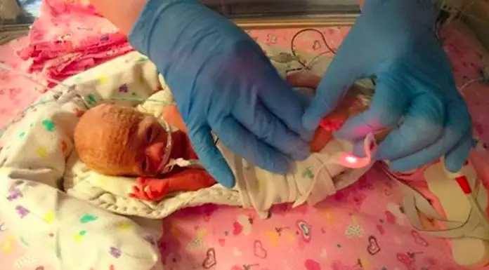 Premature baby spent her first weeks in a sandwich bag and it saved her life