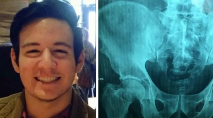 Texas teen complains of stomach ache at school, dies two hours later