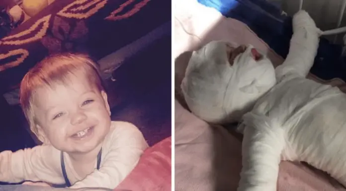 11-month-old boy who was ‘clinging onto life’ after falling into boiling water has died