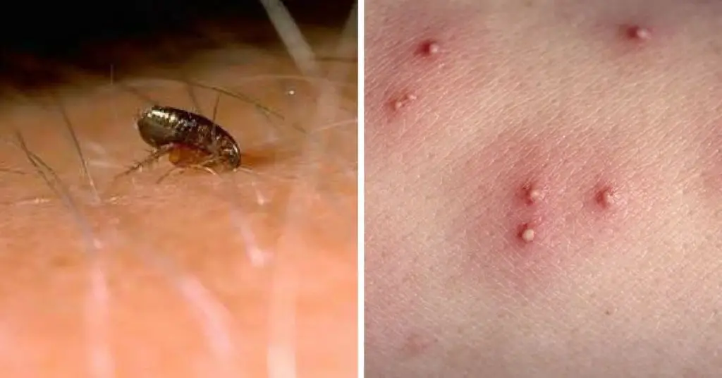 12-common-bug-bites-and-how-to-recognize-each-one