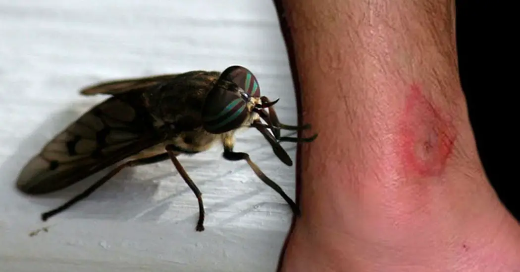 12 Common Bug Bites And How To Recognize Each One   9 3 