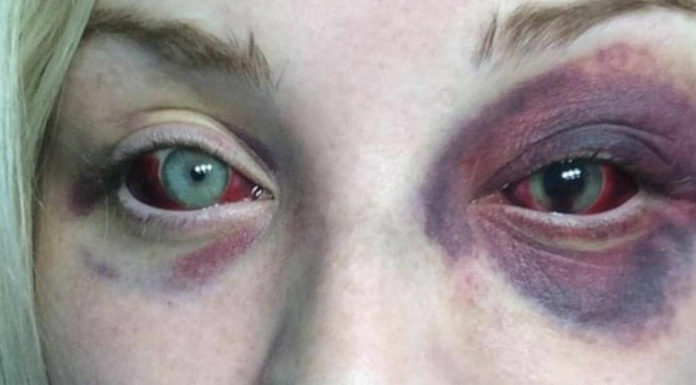 Enraged dad shares pics of daughter’s ex boyfriend and puts bounty on his head