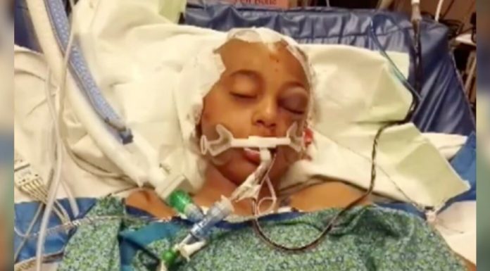 11-year-old in critical condition after being hit while getting off school bus