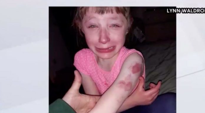 10-year-old girl with special needs bitten by student on school bus