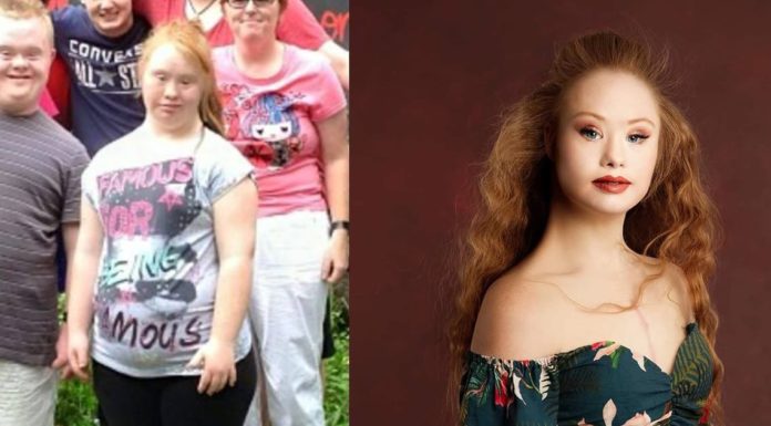 Woman With Down Syndrome Is Changing The World Of Modeling