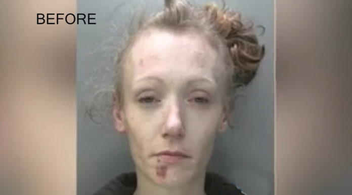 Doctors said that heroin addict only had 12 months left to live