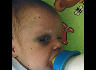 Baby is left fighting for his life after mom beats him and goes out on date