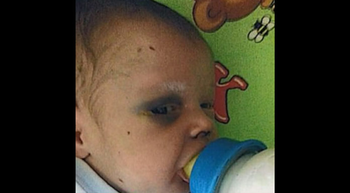 Baby is left fighting for his life after mom beats him and goes out on date