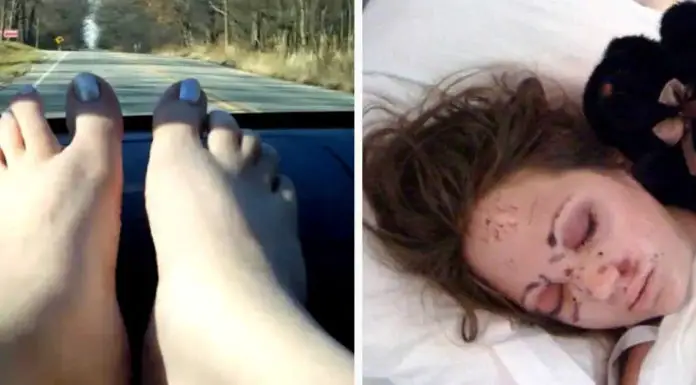 Girl rested her feet on the dashboard – It made her life change forever