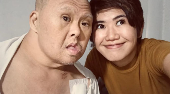 Daughter Mocked for Having a Dad With Down Syndrome Gathers Courage and Writes Post Speaking Out