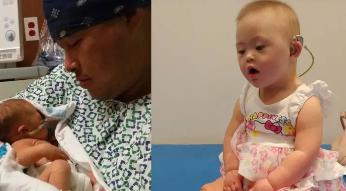 Toddler with Down syndrome who beat cancer twice now hears sound for the first time