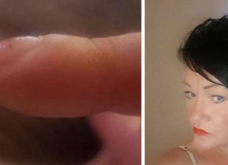 Mom posts pics of her nails on Facebook – gets message that could save her life