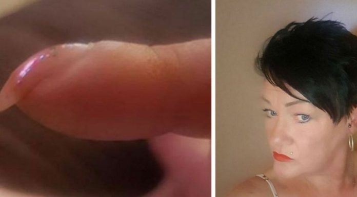 Mom posts pics of her nails on Facebook – gets message that could save her life