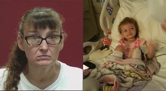 Grandmother dips girl’s feet into boiling water because she misbehaved – she could have lost both her feet