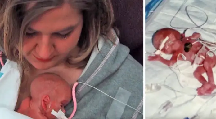 Baby Lives Despite Doctors Giving Only a Five Percent Chance of Survival