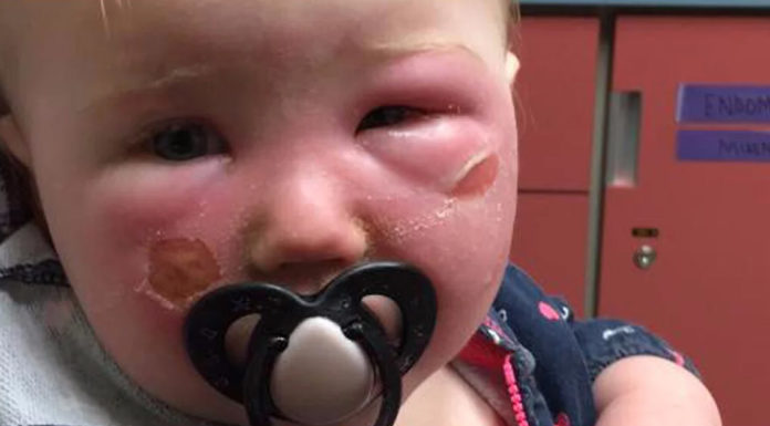 Every Parent Should Read This Mom’s Warning About Aerosol Sunscreens