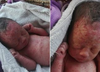 Newborn baby covered in bug bites found dumped in field in Thailand
