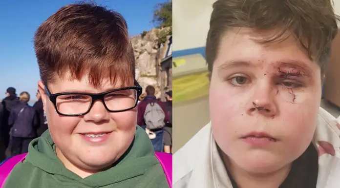 15-year-old boy nearly blinded after being victim of bullying attack school fails to prevent