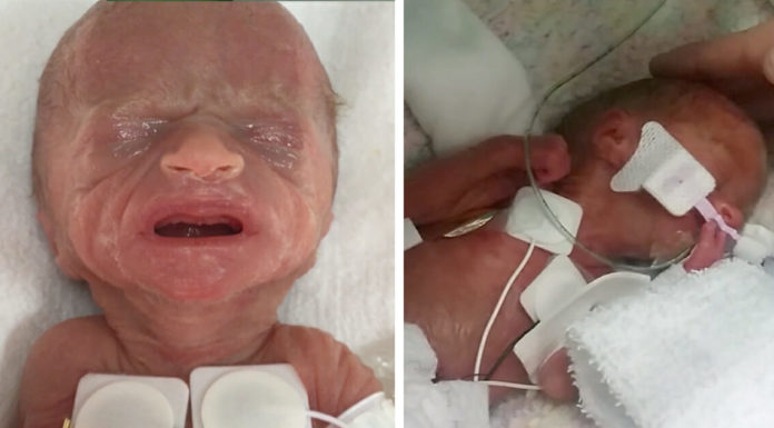 Baby girl born weighing just 1 pound leaves hospital after 4 months – see how she looks today